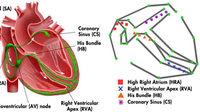 宾夕法尼亚大学开发出电心脏模型心脏起搏器的实时闭环测试