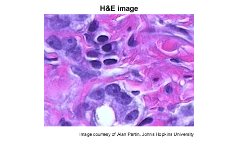 图中包含一个坐标轴。标题为H&E image的轴包含两个类型为image, text的对象。