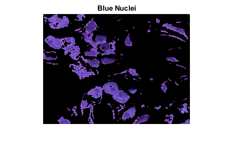 图中包含一个坐标轴。具有标题蓝核的轴包含类型图像的对象。