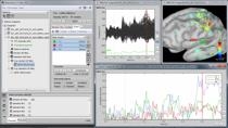 MathWorks和Brensstorm工程师将展示头脑风暴提供的基本工具，用于分析和可视化从电生理记录获得的多维复杂数据集，重点是功能性脑成像。我们