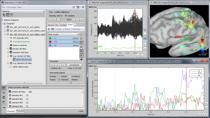 MathWorks和头脑风暴工程师将展示头脑风暴提供的基本工具，以分析和可视化从电生理记录中获得的多维、复杂的数据集，重点是脑功能成像。我们