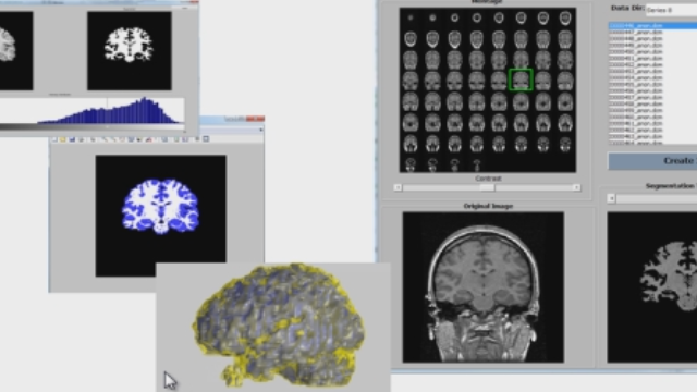 从DICOM文件加载一个MRI图像堆栈，使用分割和形态学来识别脑组织，并创建体积可视化。
