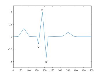 图2。ECG信号的QRS复合体。