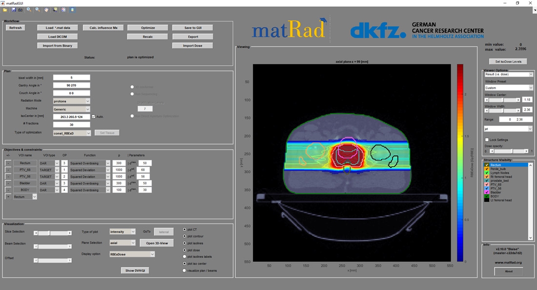 图1. Matrad 2.10.0接口，具有工作流程，计划，优化和可视化控件。界面使用两个相对的光束角和扫描质子显示前列腺处理计划