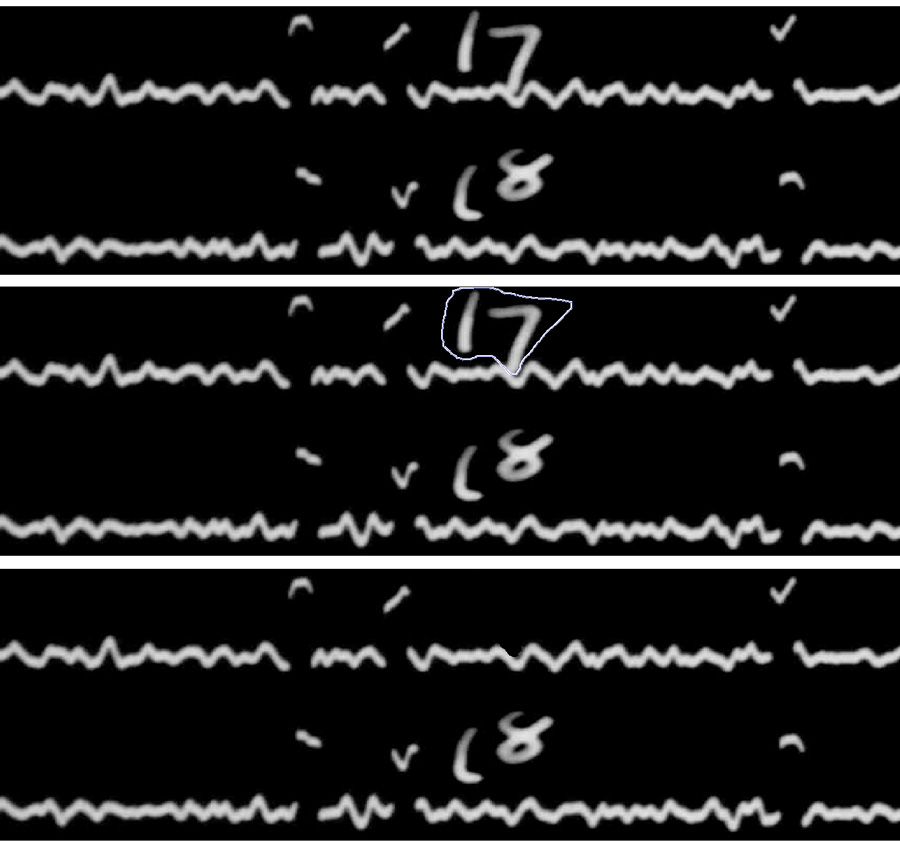 图3。上图:地震图的一部分，显示出时注(17和18)的痕迹。选择第一个计时音符(中间)，然后删除(底部)。
