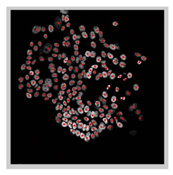 图4。处理后的图像，每个识别的核定位和标记在红色。