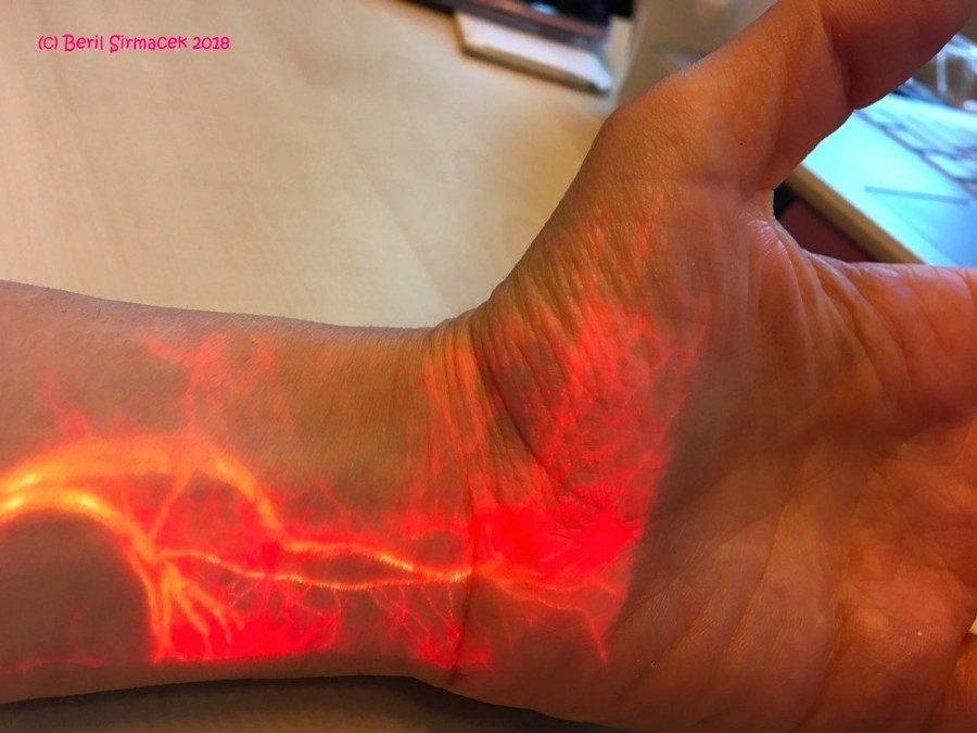 图1所示。增强现实可视化的血液流动在手腕和手。