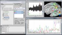 MathWorks公司和头脑风暴的工程师将演示通过头脑风暴提供给分析和可视化的电生理记录获得多方面的，复杂的数据集，对脑功能成像强调的重要工具。我们