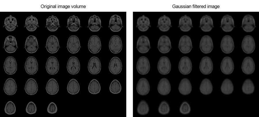 在diesem Beispiel wird gezeigt，魏某SIE MRT-BILDER EINES menschlichen Gehirns mithilfe einerGauß'schen3D-Filterung格拉滕können。