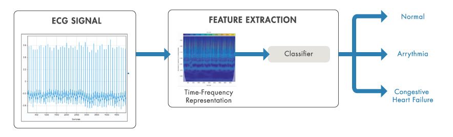 时间频率分析用于从ECG信号中提取分类的特征。