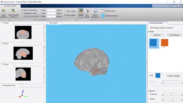 使用U-Net神经网络对3D医学图像进行脑肿瘤的分割。