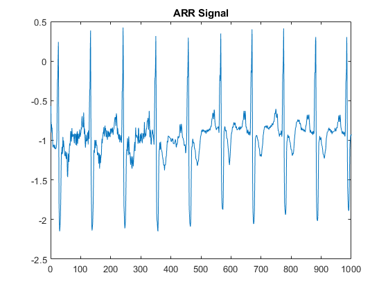 部署信号分类器使用小波和深度学习在覆盆子π