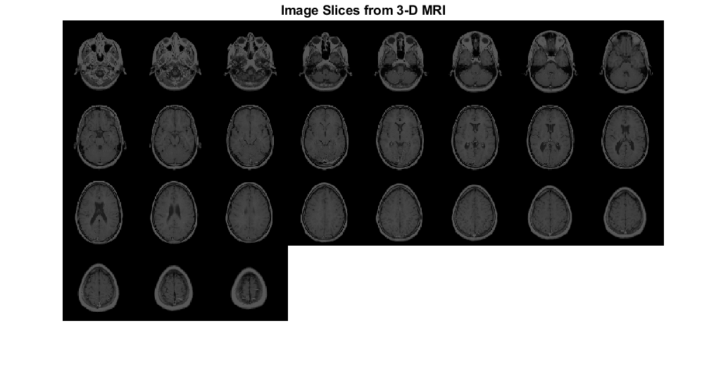 图包含轴。具有来自3-D MRI的标题图像切片的轴包含类型图像的对象。