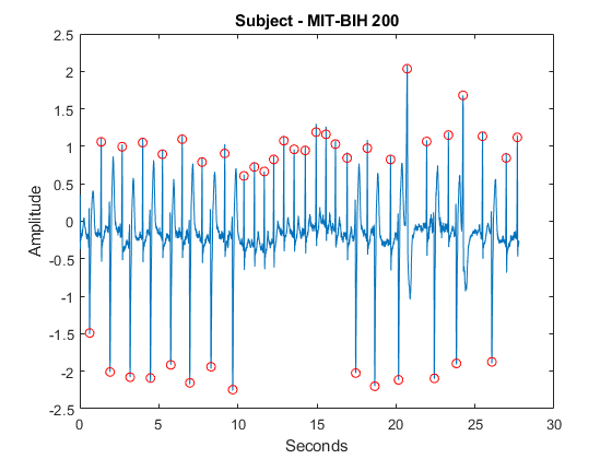 图中包含一个轴。标题为Subject-MIT-BIH 200的轴包含2个line类型的对象。