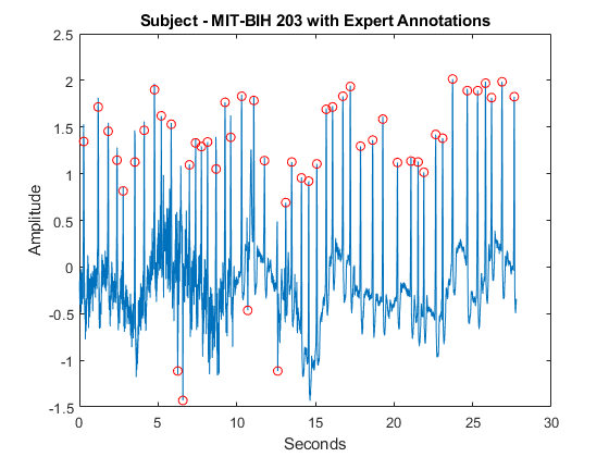 图中包含一个轴。标题为“主题-MIT-BIH 203”且带有专家注释的轴包含2个线型对象。