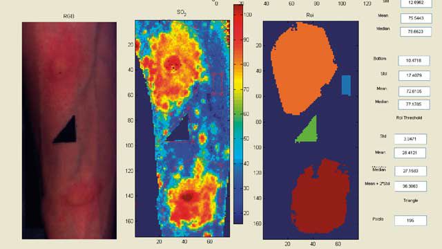 从诺丁汉大学的高光谱图像,得到了闪亮的光在组织表面和准确测量氧含量和生成氧饱和度映射到促进临床研究人员和医生的工作。