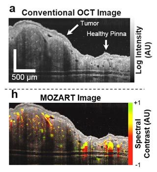 图1。上图:常规OCT图像，显示活小鼠耳廓肿瘤的组织结构。下图:同一组织区域的MOZART图像。光谱分析显示LGNRs存在于血管中。