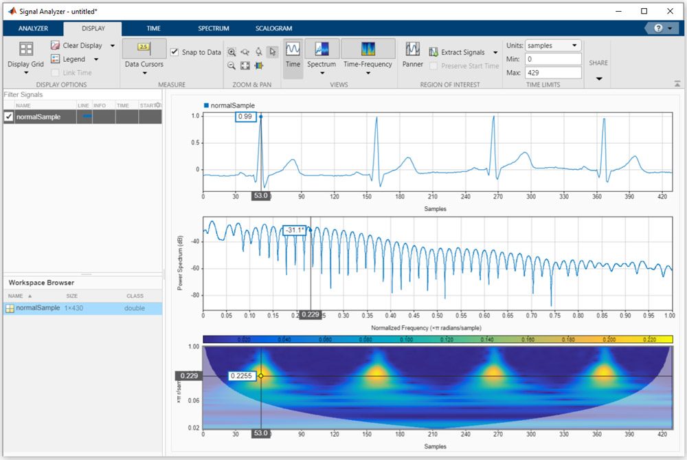 利用MATLAB中的信号分析仪应用程序分析心电信号的时、频、时频域。