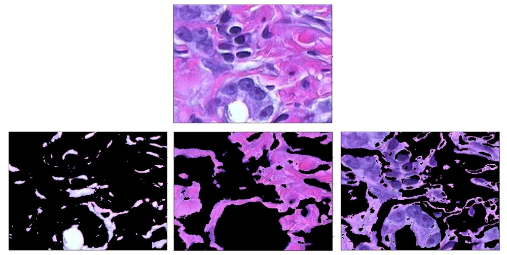 使用聚类to distinguish between tissue types in an image of body tissue stained with hematoxylin and eosin (H&E).