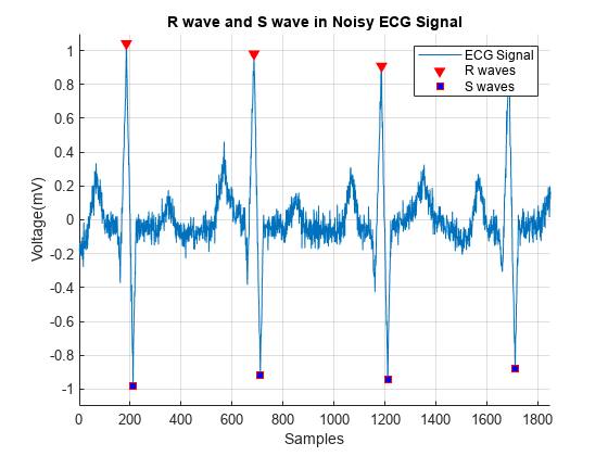 图中包含一个坐标轴。噪声心电信号中以R波和S波为标题的轴包含3个线型对象。这些物体代表心电信号，R波，S波。