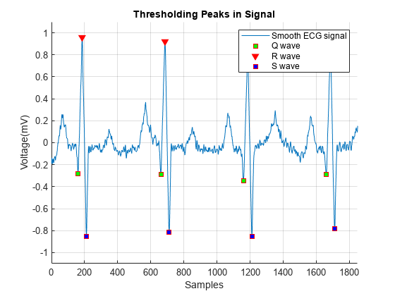 图中包含一个坐标轴。以信号中阈值峰值为标题的轴包含4个类型为line的对象。这些对象代表平滑的心电信号，Q波，R波，S波。