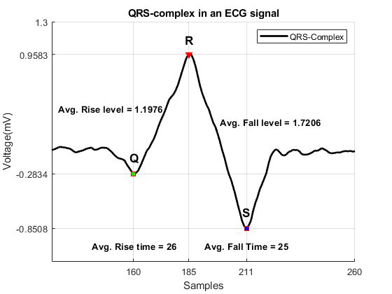 图中包含一个坐标轴。心电信号中具有qrs复型的轴包含行、文等类型的11个对象。这些对象代表QRS-Complex, Peak, Minima。
