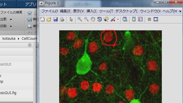 神経細胞の染色画像から、赤色に染色されているコアの数を自動的にカウントする画像処理のアルゴリズムを、MATLAB上で構築していく流れをご紹介します。