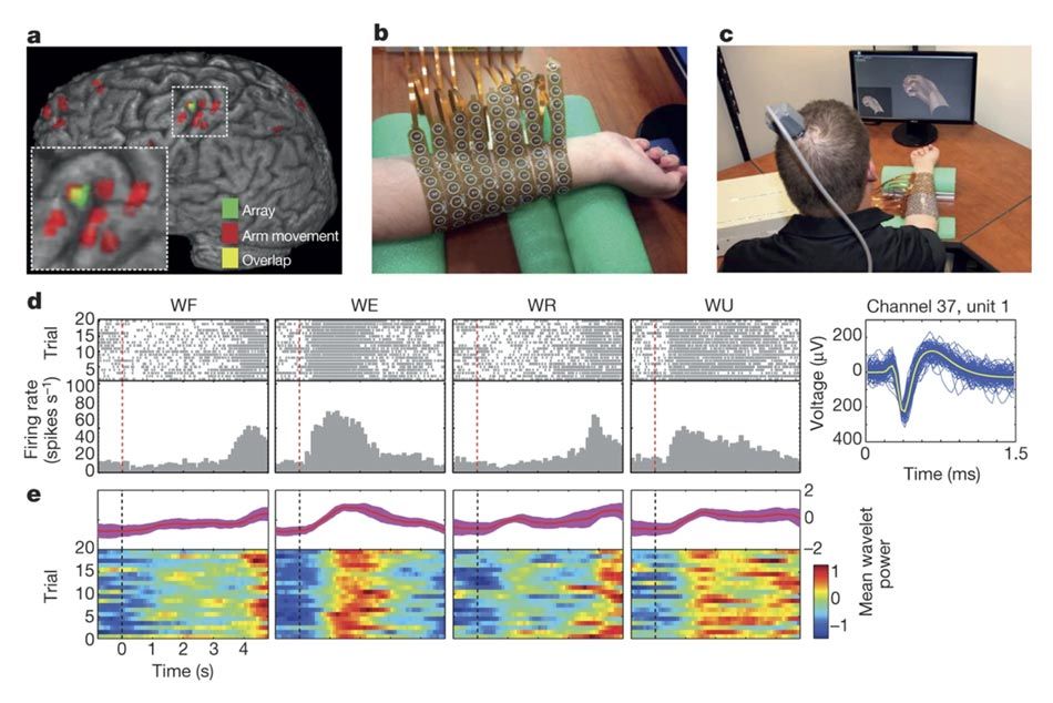 这张照片是2016年NeuroLife研究。在大脑的左上角是一个图像显示的位置植入微型智能电网